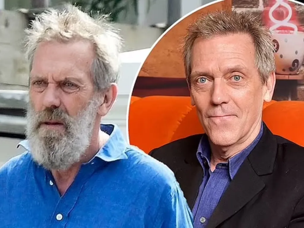 Hollywood’s Hair Secrets: Celebrities Who Wear Wigs Regularly 10 Hugh Laurie is actors usually use wigs or hairpieces for character continuity