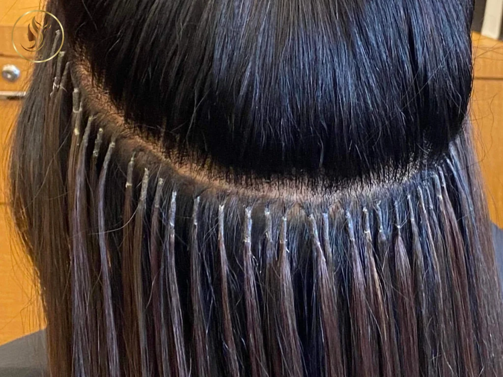 Glue-in methods have many advantages