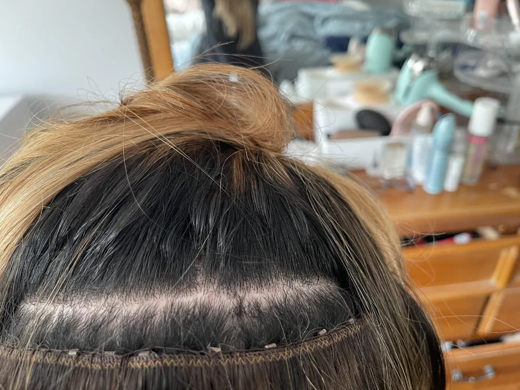 Weft Hair Extensions Damage: The Ultimate Guide to Protect Your Hair 7 Itchy bumps may signal folliculitis or allergies—use hypoallergenic beads and lower tension.